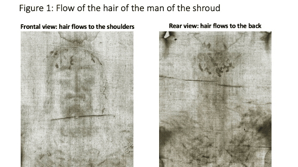The Shroud of Jesus: The Discovery of the Image of an Upright Man